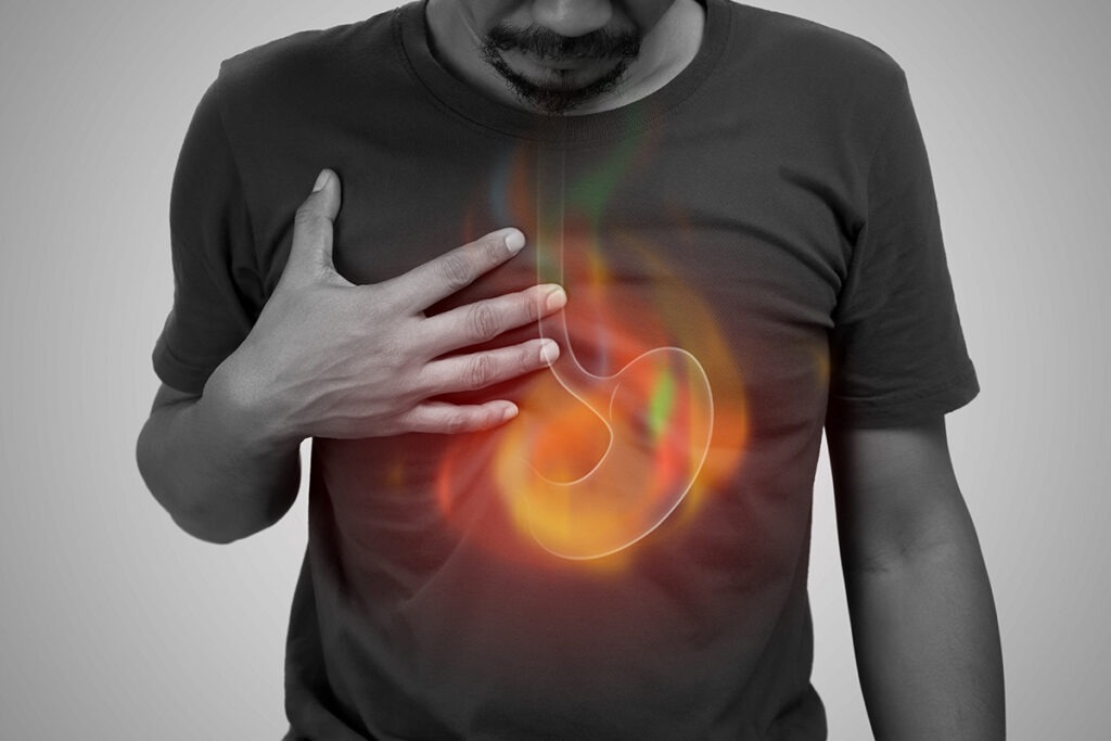 Reflujo, colitis o algo más: ¿cuándo acudir con un gastroenterólogo?